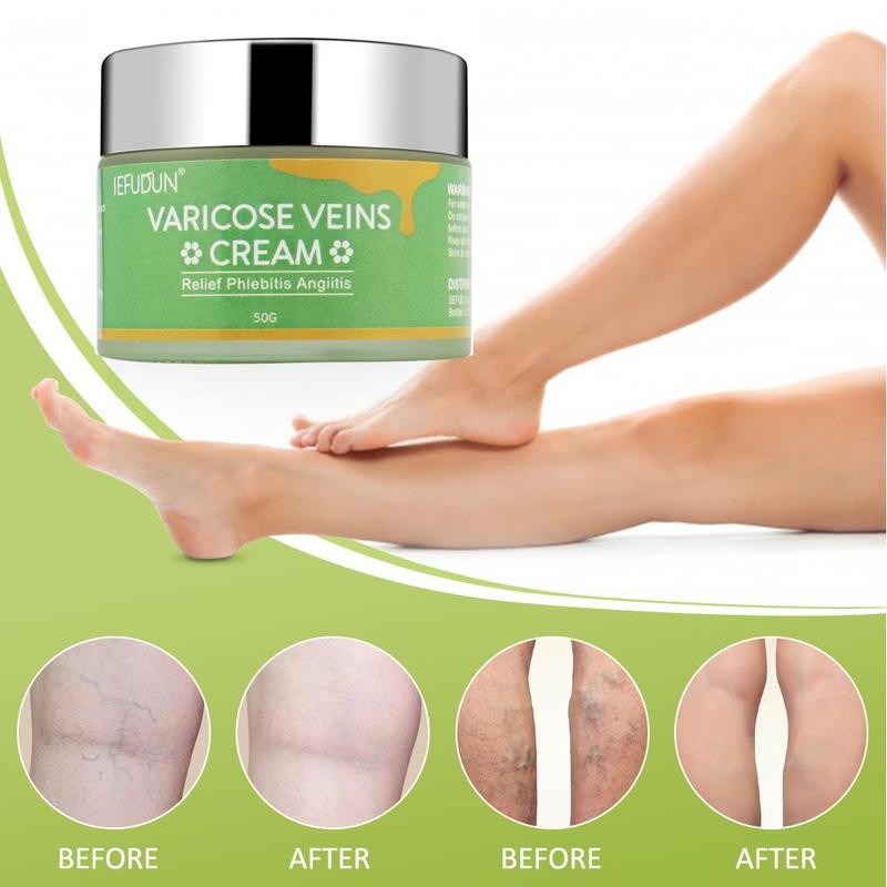 Vena Crema per Vene Varicose